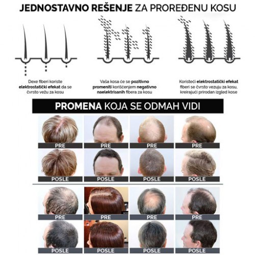 DERMA HAIR Fiberi za kosu 22gr