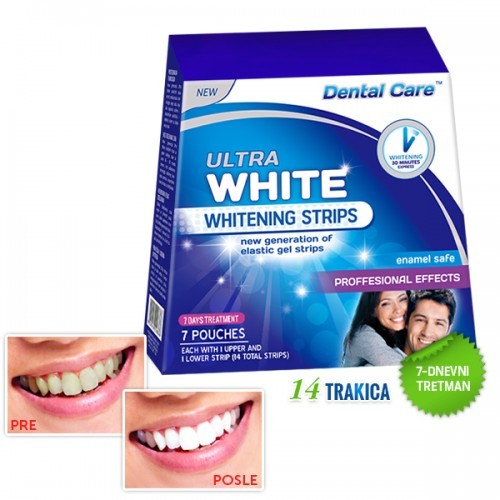Trake za izbeljivanje zuba - Ultra White 7 dana