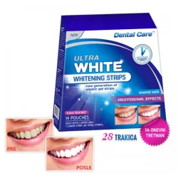 ULTRA WHITE Trake za izbeljivanje zuba – 14 dana